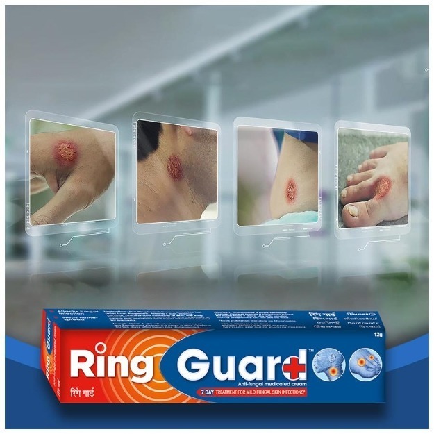 Ring guard Review | ring guard treatment | ring guard cream uses | ring  guard cream ke fayde - YouTube